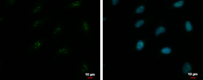 ZNF556 Antibody in Immunocytochemistry (ICC/IF)