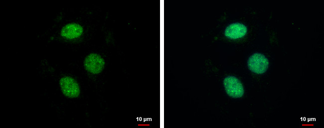 ZNF599 Antibody in Immunocytochemistry (ICC/IF)
