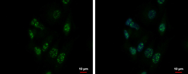 ZNF624 Antibody in Immunocytochemistry (ICC/IF)