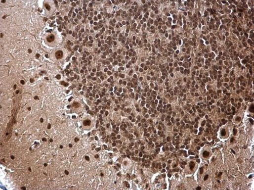 ZNF691 Antibody in Immunohistochemistry (Paraffin) (IHC (P))