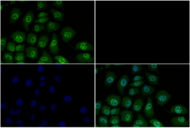 Phospho-SMAD2/SMAD3 (Thr8) Antibody in Immunocytochemistry (ICC/IF)