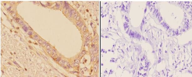 ADD1/ADD2 Antibody in Immunohistochemistry (Paraffin) (IHC (P))