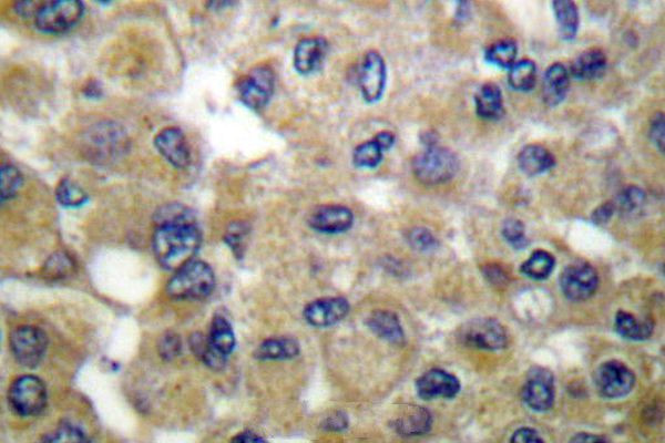 Mammaglobin B Antibody in Immunohistochemistry (Paraffin) (IHC (P))