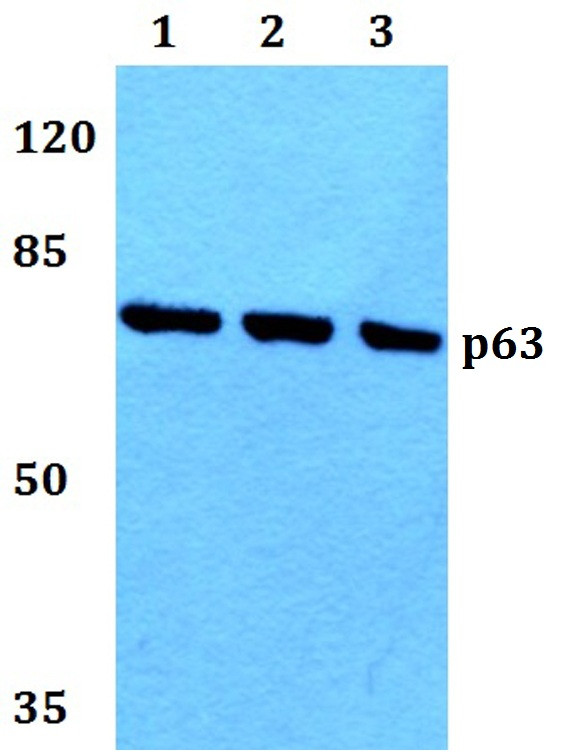 p63 Antibody in Western Blot (WB)