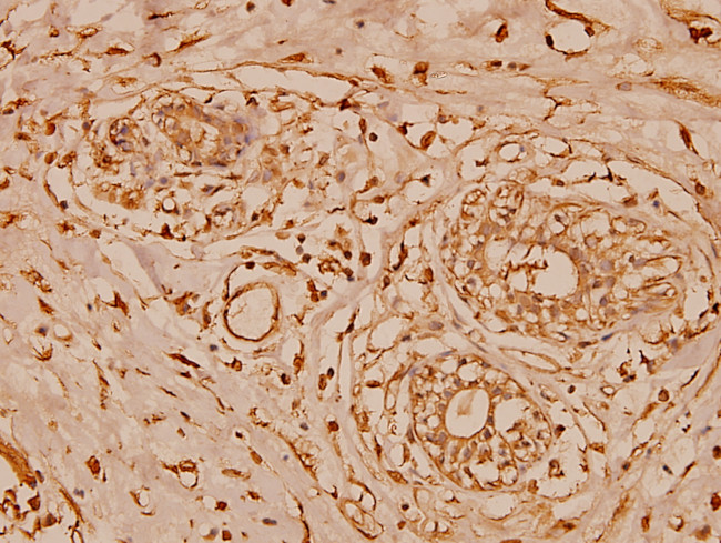 Cystatin B Antibody in Immunohistochemistry (Paraffin) (IHC (P))