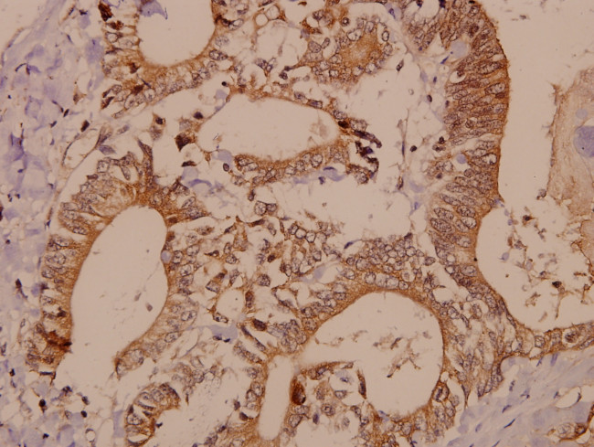 PAK1/2/3 Antibody in Immunohistochemistry (Paraffin) (IHC (P))