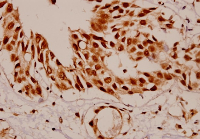 SF1 Antibody in Immunohistochemistry (Paraffin) (IHC (P))