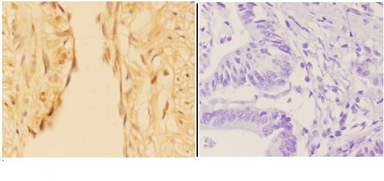 APC1 Antibody in Immunohistochemistry (Paraffin) (IHC (P))