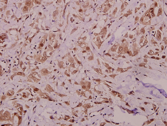 RyR2 Antibody in Immunohistochemistry (Paraffin) (IHC (P))