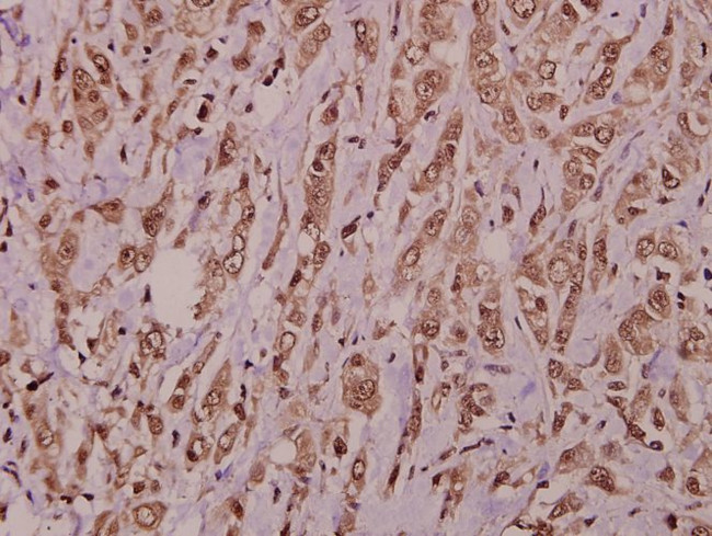 AKAP10 Antibody in Immunohistochemistry (Paraffin) (IHC (P))