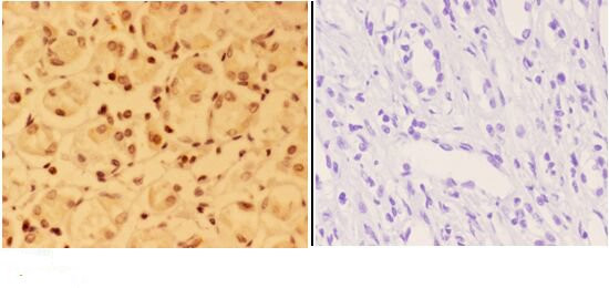 ALX3 Antibody in Immunohistochemistry (Paraffin) (IHC (P))