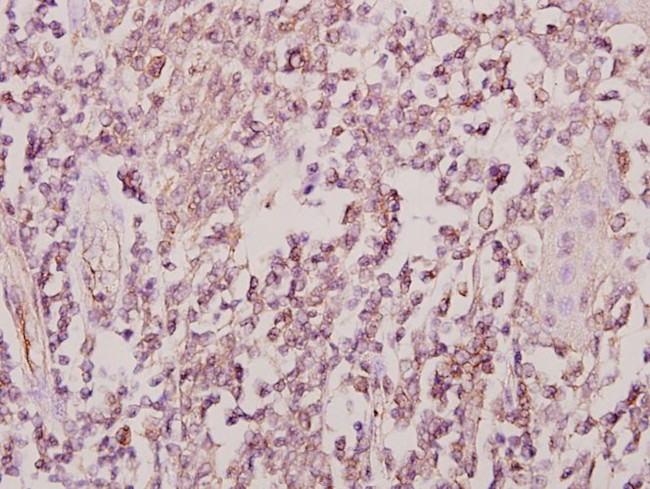 ZRANB2 Antibody in Immunohistochemistry (Paraffin) (IHC (P))