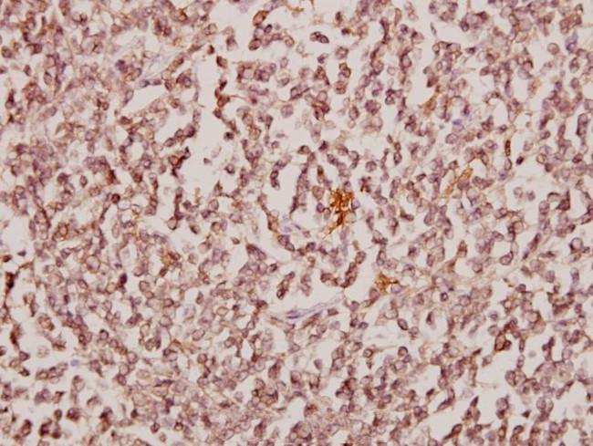 CBX6 Antibody in Immunohistochemistry (Paraffin) (IHC (P))