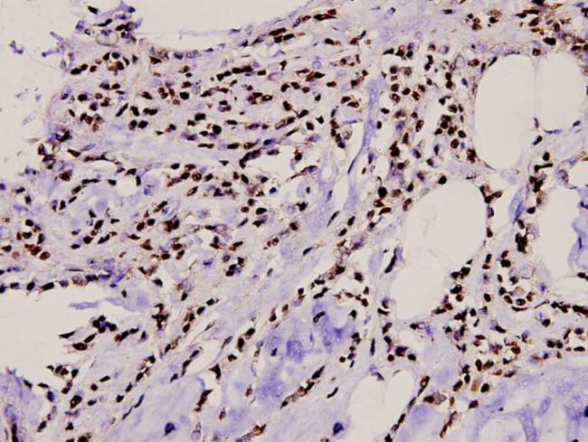 TBX15/TBX18 Antibody in Immunohistochemistry (Paraffin) (IHC (P))