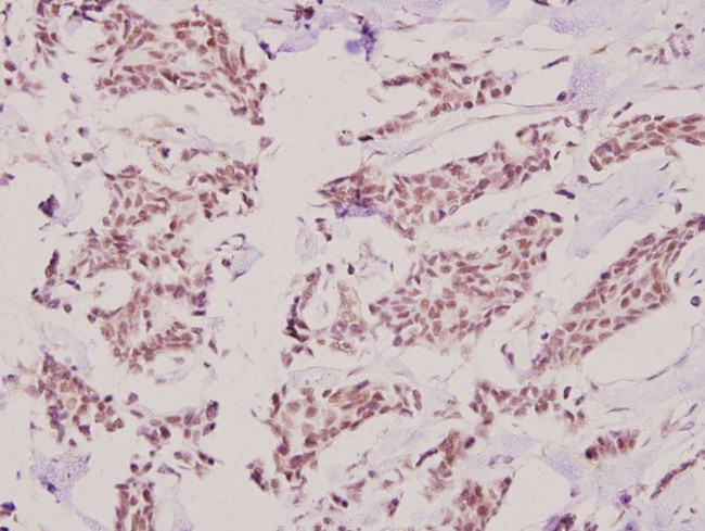 HKR1 Antibody in Immunohistochemistry (Paraffin) (IHC (P))