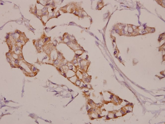 AKAP5 Antibody in Immunohistochemistry (Paraffin) (IHC (P))