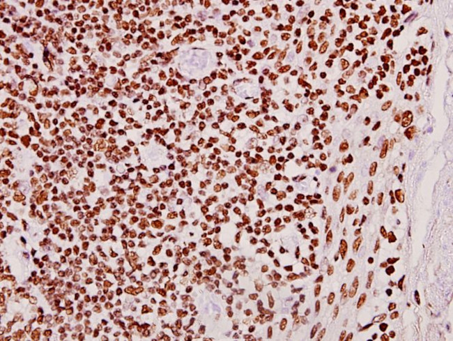 CLK2 Antibody in Immunohistochemistry (Paraffin) (IHC (P))
