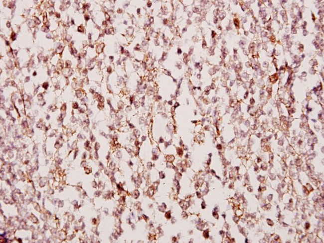 TUSC3 Antibody in Immunohistochemistry (Paraffin) (IHC (P))