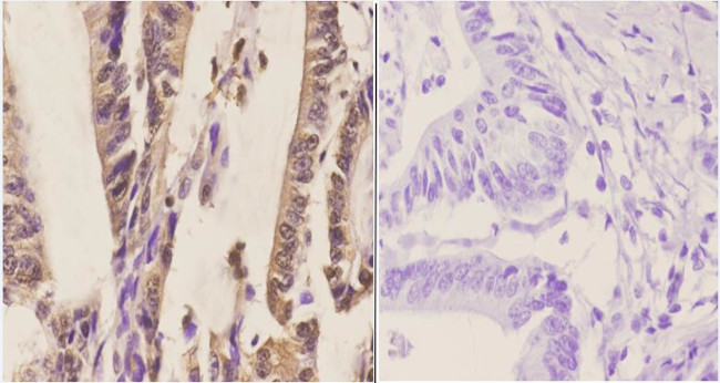 SS18 Antibody in Immunohistochemistry (Paraffin) (IHC (P))