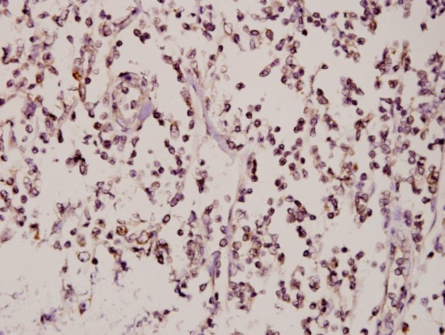 ZNF174 Antibody in Immunohistochemistry (Paraffin) (IHC (P))