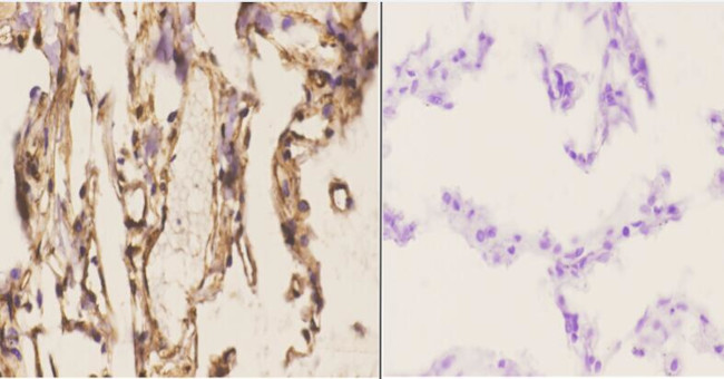 CDKL2 Antibody in Immunohistochemistry (Paraffin) (IHC (P))