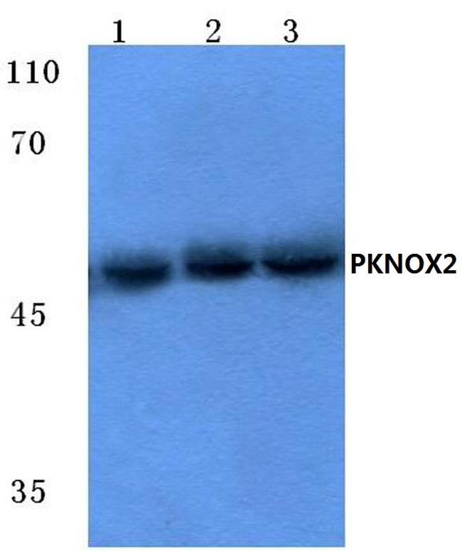 PKNOX2 Antibody in Western Blot (WB)
