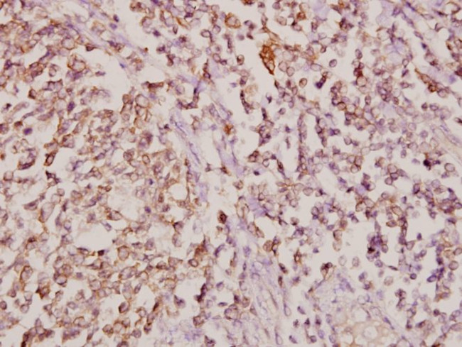 COL11A1 Antibody in Immunohistochemistry (Paraffin) (IHC (P))