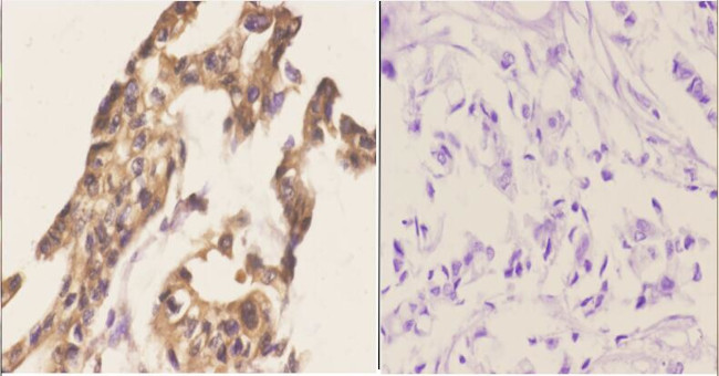 CABLES1 Antibody in Immunohistochemistry (Paraffin) (IHC (P))