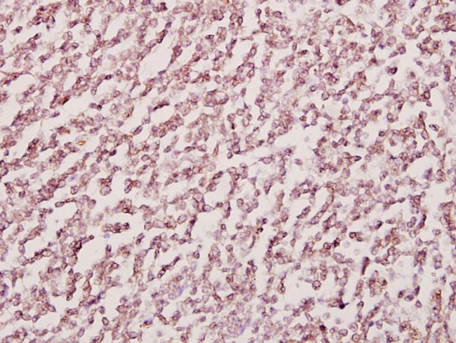 H-cadherin Antibody in Immunohistochemistry (Paraffin) (IHC (P))