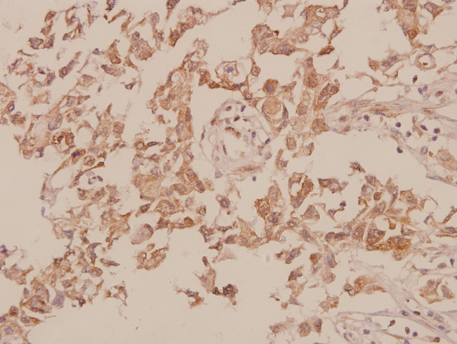 M-cadherin Antibody in Immunohistochemistry (Paraffin) (IHC (P))