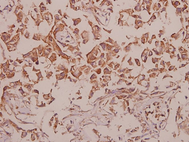 CDH18 Antibody in Immunohistochemistry (Paraffin) (IHC (P))