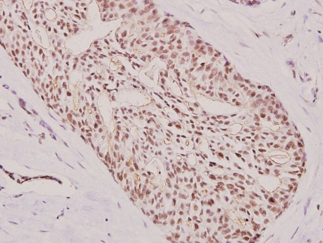 ATF3 Antibody in Immunohistochemistry (Paraffin) (IHC (P))