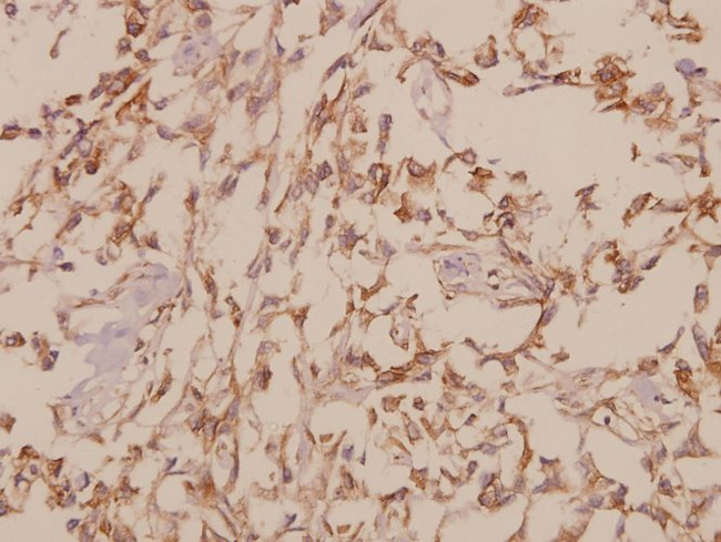 GTF2H1 Antibody in Immunohistochemistry (Paraffin) (IHC (P))