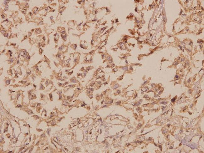 hnRNP H2 Antibody in Immunohistochemistry (Paraffin) (IHC (P))