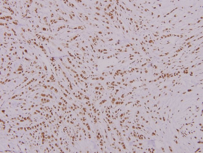 FOXK1 Antibody in Immunohistochemistry (Paraffin) (IHC (P))