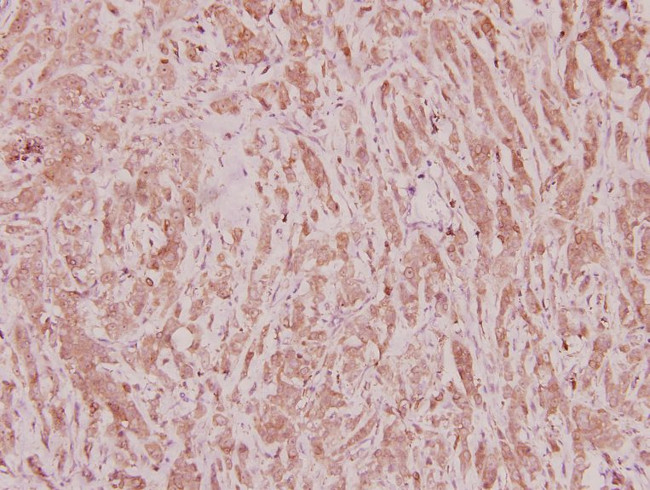 C/EBP zeta Antibody in Immunohistochemistry (Paraffin) (IHC (P))