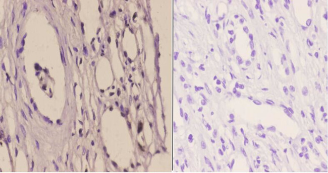 GTF2H2 Antibody in Immunohistochemistry (Paraffin) (IHC (P))
