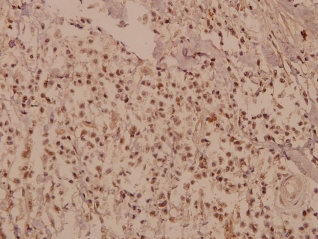 CUG-BP Antibody in Immunohistochemistry (Paraffin) (IHC (P))