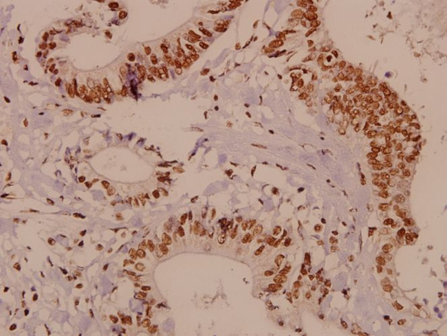 HES6 Antibody in Immunohistochemistry (Paraffin) (IHC (P))