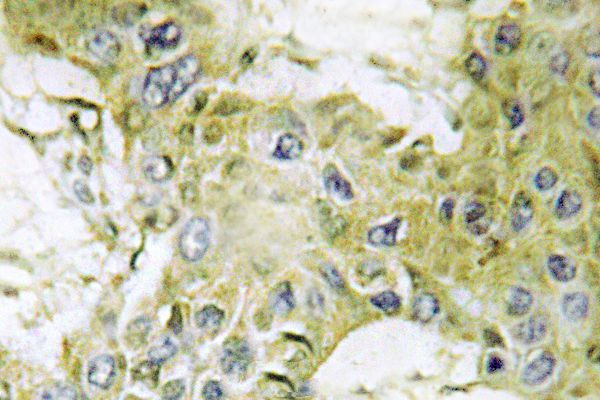 CK1 gamma-1 Antibody in Immunohistochemistry (Paraffin) (IHC (P))
