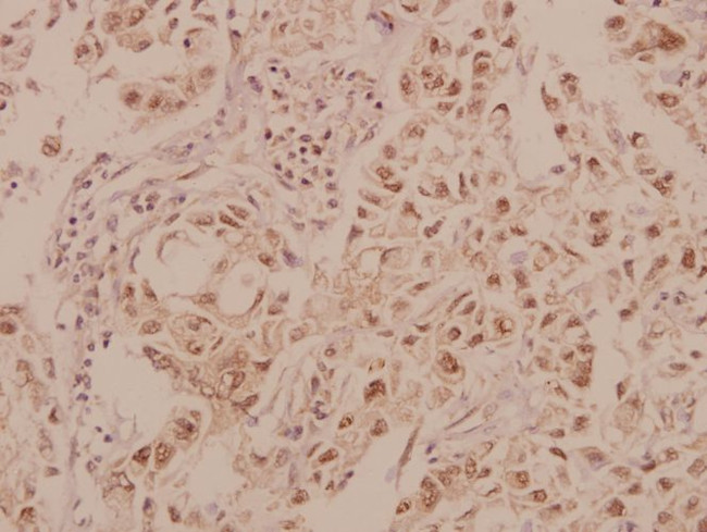 MRCK beta Antibody in Immunohistochemistry (Paraffin) (IHC (P))