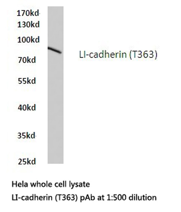CDH17 Antibody in Western Blot (WB)