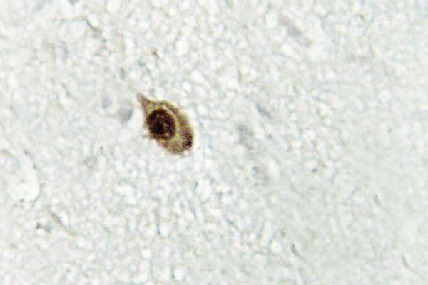 ZIC1/ZIC2/ZIC3 Antibody in Immunohistochemistry (Paraffin) (IHC (P))