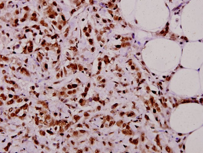 TAF5L Antibody in Immunohistochemistry (Paraffin) (IHC (P))