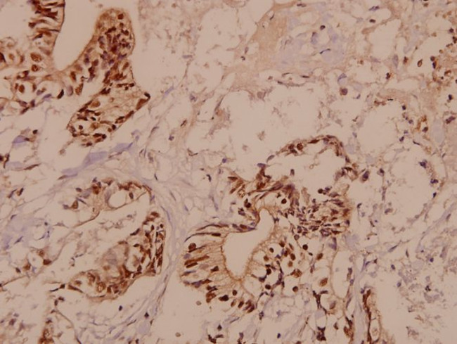 RBM5 Antibody in Immunohistochemistry (Paraffin) (IHC (P))