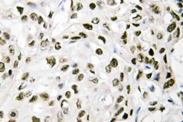 VPS72 Antibody in Immunohistochemistry (Paraffin) (IHC (P))