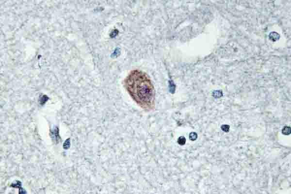 DOK6 Antibody in Immunohistochemistry (Paraffin) (IHC (P))