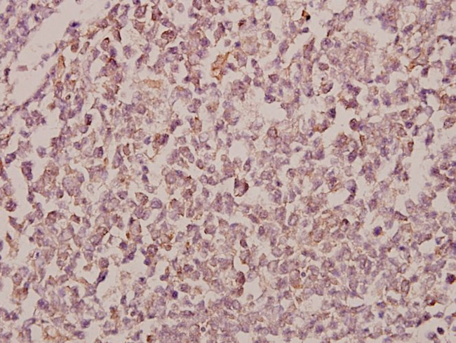 RhoBTB1/RhoBTB2 Antibody in Immunohistochemistry (Paraffin) (IHC (P))