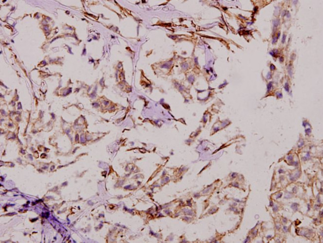 DATF1 Antibody in Immunohistochemistry (Paraffin) (IHC (P))