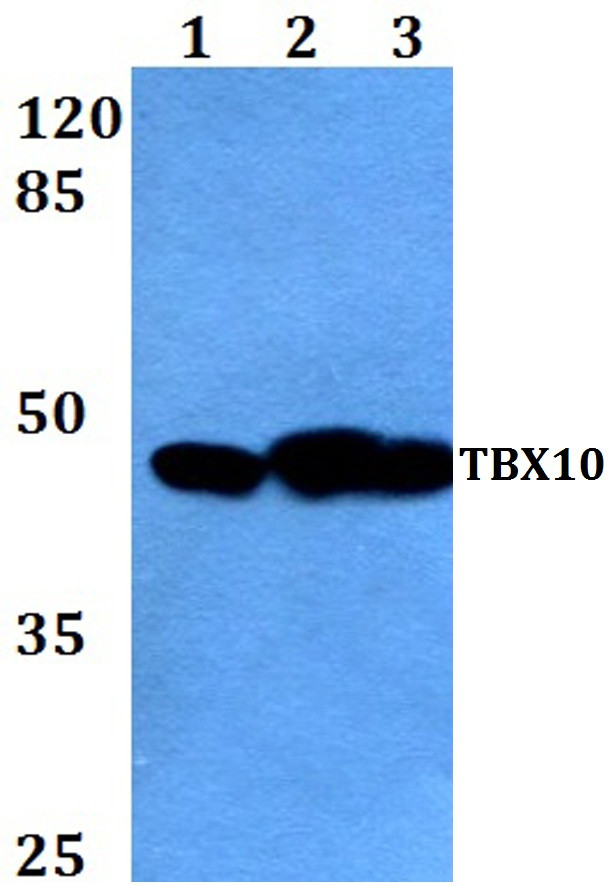 TBX10 Antibody in Western Blot (WB)